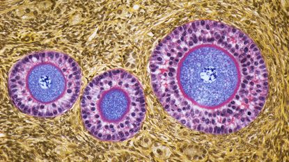 image of three human egg cells inside ovarian follicles