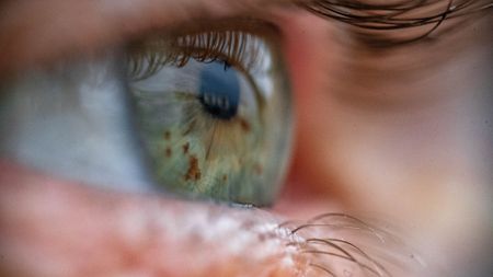 A close-up image of a person's eye.